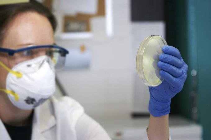 Le colture prelevate da una persona infetta dall'antrace mostrano i batteri a forma di bastoncino.