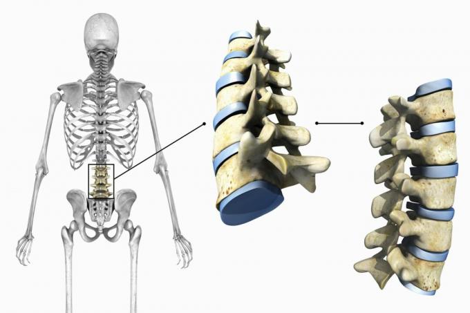 Diagramma che mostra le vertebre lombari e le articolazioni su uno sfondo bianco.
